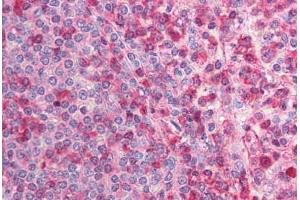 Human Spleen (formalin-fixed, paraffin-embedded) stained with CACNB2 antibody ABIN214732 at 5 ug/ml followed by biotinylated goat anti-rabbit IgG secondary antibody ABIN481713, alkaline phosphatase-streptavidin and chromogen. (CACNB2 antibody  (N-Term))