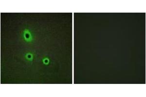 Immunofluorescence analysis of A549 cells, using EFNA5 Antibody. (Ephrin A5 antibody  (AA 31-80))