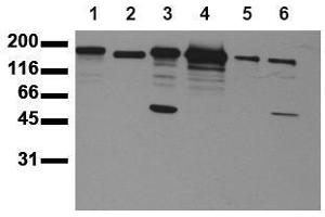 Western Blotting (WB) image for anti-Receptor tyrosine-protein kinase erbB-2 (ErbB2/Her2) (AA 1240-1260) antibody (ABIN126791) (ErbB2/Her2 antibody  (AA 1240-1260))
