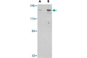 Western blot analysis of CLIP1 in rat brain tissue lysate with CLIP1 polyclonal antibody  at (A) 0.