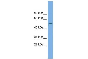 WB Suggested Anti-CAMK1G Antibody Titration: 0.