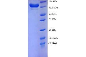 SDS-PAGE (SDS) image for Matrix Metallopeptidase 14 (Membrane-inserted) (MMP14) (AA 112-582) protein (His-SUMO Tag) (ABIN5709943) (MMP14 Protein (AA 112-582) (His-SUMO Tag))