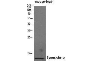 Western Blotting (WB) image for anti-Synuclein, alpha (SNCA) (N-Term) antibody (ABIN3177571) (SNCA antibody  (N-Term))