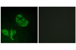 Immunofluorescence analysis of A549 cells, using GPR20 antibody. (GPR20 antibody  (C-Term))