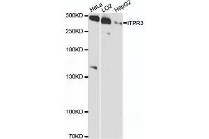 Western blot analysis of extracts of various cell lines, using ITPR3 antibody (ABIN6132120, ABIN6142616, ABIN6142617 and ABIN6216547) at 1:3000 dilution. (ITPR3 antibody  (AA 1630-1870))