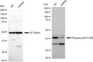 Western blotting analysis using Phospho-p38 (T180) antibody (ABIN7799445).