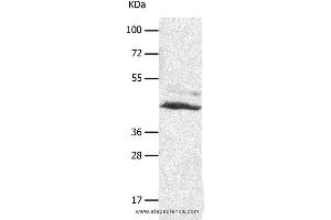 Western blot analysis of A549 cell, using SLC16A7 Polyclonal Antibody at dilution of 1:450 (SLC16A7 antibody)