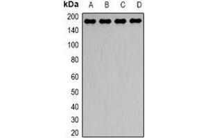 Western blot analysis of Dynactin 1 expression in Hela (A), HepG2 (B), mouse brain (C), mouse lung (D) whole cell lysates. (Dynactin 1 antibody)