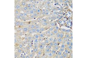 Immunohistochemistry of paraffin-embedded rat liver using PROCR antibody (ABIN6291490) at dilution of 1:200 (40x lens).