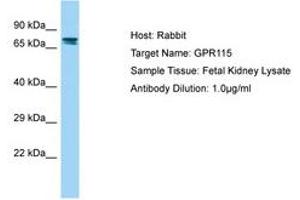 Image no. 1 for anti-G Protein-Coupled Receptor 115 (GPR115) (N-Term) antibody (ABIN6750188) (G Protein-Coupled Receptor 115 antibody  (N-Term))