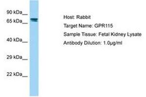 G Protein-Coupled Receptor 115 antibody  (N-Term)