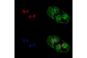 ABIN6262504 and ABIN6268640 staining  cells by IF/ICC.