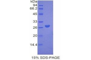SDS-PAGE (SDS) image for Coagulation Factor IX (F9) (AA 241-463) protein (His tag) (ABIN2120823)