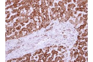 IHC-P Image VDAC2 antibody [C2C3], C-term detects VDAC2 protein at mitochondria on human normal liver by immunohistochemical analysis.