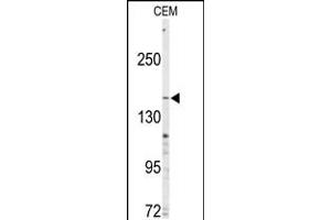 Western blot analysis of anti-ABCC4 Antibody in CEM cell line lysates (35ug/lane) (ABCC4 antibody  (C-Term))