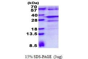 Chromosome 1open Reading Frame 89 (C1orf89) (AA 1-258) protein (His tag)