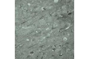 IHC on mouse brain (cryo section) using Rabbit antibody to Synaptotagmin 17  at a concentration of 50 µg/ml incubated overnight at 4C. (SYT17 antibody  (Internal Region))