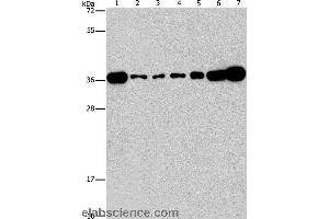 Western blot analysis of Lovo, A431, A549, hela, hepG2 and Raji cell, mouse brain tissue, using CRKL Polyclonal Antibody at dilution of 1:550 (CrkL antibody)