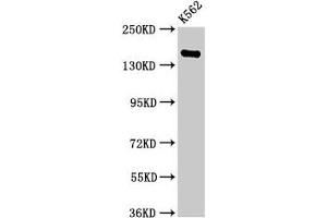 Western Blot Positive WB detected in: K562 whole cell lysate All lanes: FGD6 antibody at 2. (FGD6 antibody  (AA 1138-1352))