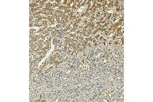 IHC analysis of LIPC using anti-LIPC antibody (ABIN7601582). (LIPC antibody  (AA 39-494))