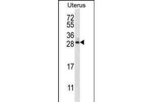 ARL8A Antibody (Center) (ABIN657381 and ABIN2846426) western blot analysis in human normal Uterus tissue lysates (35 μg/lane). (ARL8A antibody  (AA 82-110))