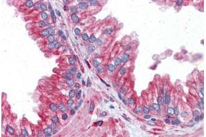Prostate: Formalin-Fixed, Paraffin-Embedded (FFPE) (TUBA4A antibody  (AA 1-449))