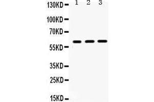 Western Blotting (WB) image for anti-HNF1 Homeobox B (HNF1B) (AA 496-525), (C-Term) antibody (ABIN3042452) (HNF1B antibody  (C-Term))
