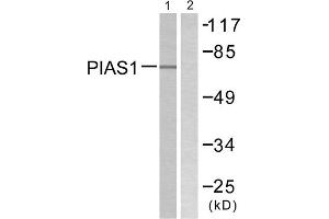 Western blot analysis of extracts from MDA-MB-435 cells, using PIAS1 antibody. (PIAS1 antibody  (N-Term))