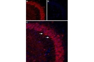 Immunohistochemistry (IHC) image for anti-Purinergic Receptor P2Y, G-Protein Coupled, 1 (P2RY1) (AA 207-220), (Extracellular) antibody (ABIN7043584)