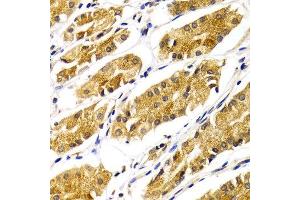 Immunohistochemistry of paraffin-embedded Human gastric using ABO antibody at dilution of 1:100 (x400 lens). (ABO antibody)