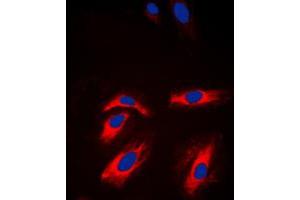 Immunofluorescent analysis of Creatine Kinase M staining in NIH3T3 cells. (CKM antibody  (N-Term))