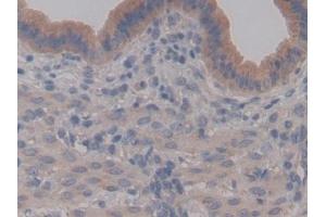 Immunohistochemistry (IHC) image for anti-Bactericidal/Permeability Increasing Protein (BPI) (AA 320-457) antibody (ABIN7433300)