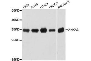 Western blot analysis of extracts of various cell lines, using ANXA3 antibody. (Annexin A3 antibody  (AA 1-323))