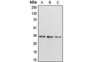 Western blot analysis of Apolipoprotein L2 expression in HepG2 (A), mouse liver (B), rat brain (C) whole cell lysates. (Apolipoprotein L 2 antibody  (Center))