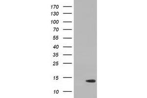 HEK293T cells were transfected with the pCMV6-ENTRY control (Left lane) or pCMV6-ENTRY RIPPLY2 (Right lane) cDNA for 48 hrs and lysed. (RIPPLY2 antibody)