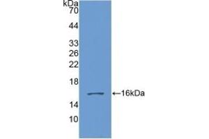 Detection of Recombinant GDF6, Human using Polyclonal Antibody to Growth Differentiation Factor 6 (GDF6) (GDF6 antibody  (AA 336-455))