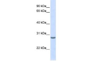 Western Blotting (WB) image for anti-Tetraspanin 6 (TSPAN6) antibody (ABIN2458934)