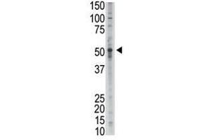Image no. 1 for anti-Growth Differentiation Factor 2 (GDF2) (N-Term) antibody (ABIN357458) (GDF2 antibody  (N-Term))