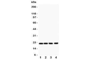Western blot testing of DHFR antibody and Lane 1:  rat liver (Dihydrofolate Reductase antibody  (AA 2-187))