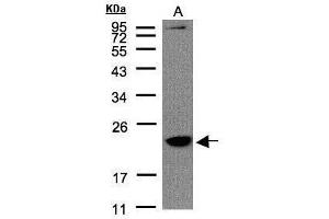 WB Image Sample(30 μg of whole cell lysate) A:Raji, 12% SDS PAGE antibody diluted at 1:1500 (TMEM147 antibody)