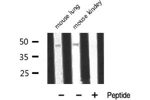 Western blot analysis of ADA2L expression in various lysates (TADA2L antibody)