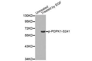 Western blot analysis of extracts from 293 cells, using Phospho-PDPK1-S241 antibody (ABIN2988238). (PDPK1 antibody  (pSer241))