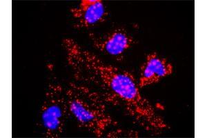 Proximity Ligation Analysis of protein-protein interactions between TBL1X and CTNNB1. (TBL1X antibody  (AA 1-526))