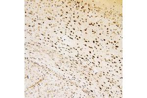 IHC analysis of SOX15 using anti-SOX15 antibody (ABIN6719624). (SOX15 antibody  (AA 1-233))