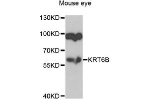 Western blot analysis of extracts of mouse eye, using KRT6B antibody (ABIN2737066) at 1:1000 dilution.