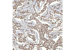 IHC analysis of SNRNP40 using anti-SNRNP40 antibody (ABIN7601719).