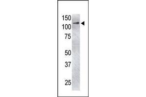 The anti-USP4 C-term Pab (ABIN388883 and ABIN2839175) is used in Western blot to detect USP4 in USP4-transfected HeLa cell lysate. (USP4 antibody  (C-Term))