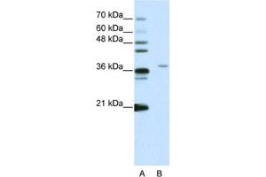 Western Blotting (WB) image for anti-Squamous Cell Carcinoma Antigen Recognized By T Cells 3 (SART3) antibody (ABIN2461855)