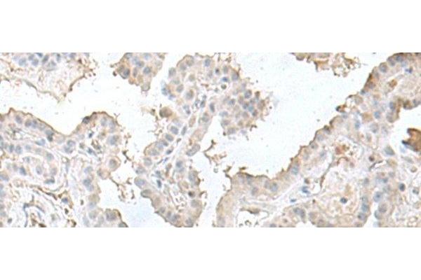 LSM10 antibody