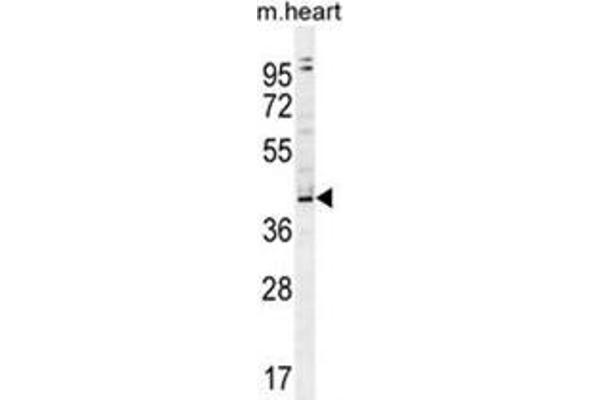 ZBTB42 Antikörper  (N-Term)